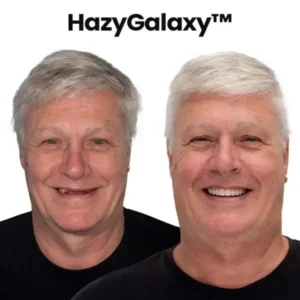 🦷HazyGalaxy™ Custom-Fit Functional Dentures — Made in the USA, Up to 70% OFF for a More Confident Smile!