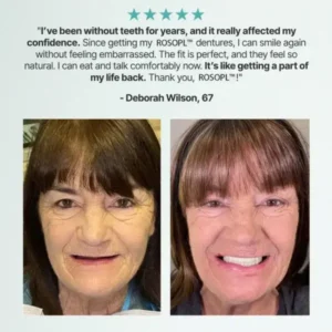 🦷HazyGalaxy™ Custom-Fit Functional Dentures — Made in the USA, Up to 70% OFF for a More Confident Smile!